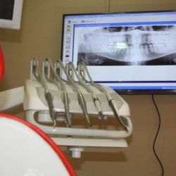 Clínica Dental Seseña. Gabinete 01